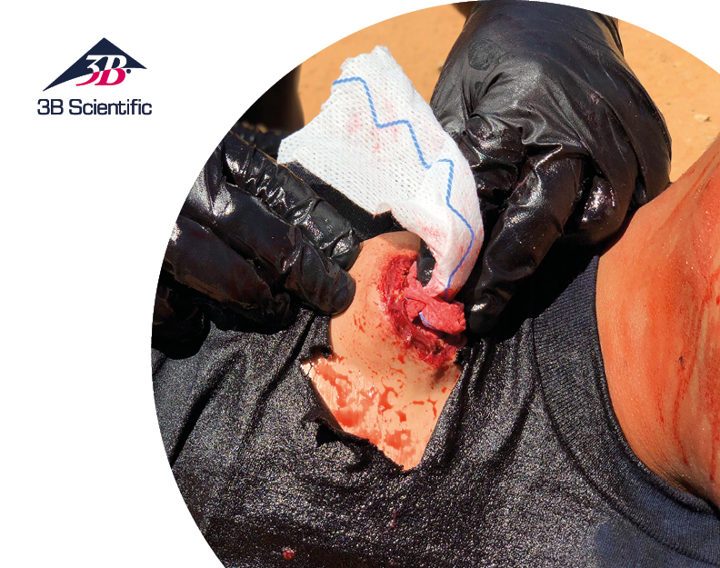 3B_Scientific_25-10_Banner_STOPS_Moulage_Kit_OVERVIEWSMALL.jpg