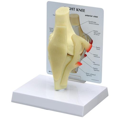 Базовая модель коленного сустава, 1019499, Модели суставов, кисти и стопы человека