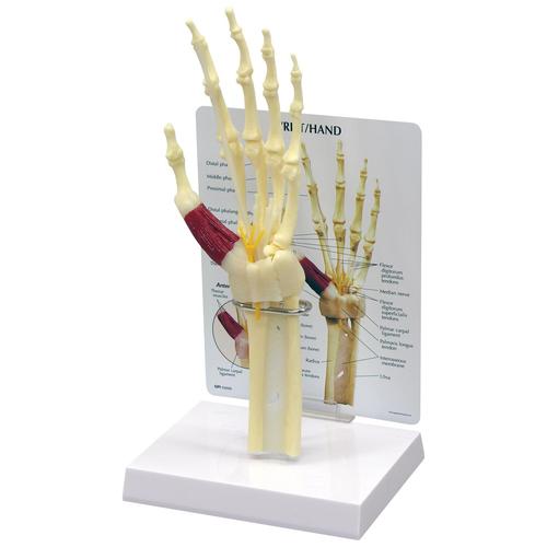 Hand/Wrist Carpal Tunnel Syndrome Model, 1019519, Arm and Hand Skeleton Models