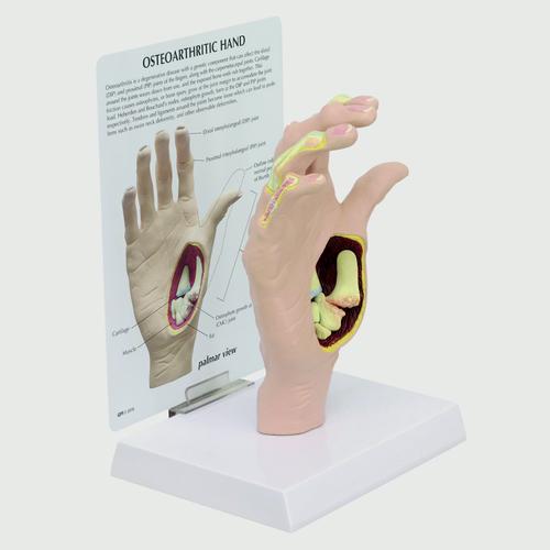 Osteoarthritis Hand Model, 1019520, Muscle Models