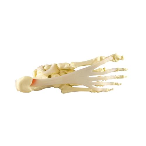 Modelo de P&eacute;/Tornozelo - Fascite Plantar, 1019522, Modelos de esqueletos da perna e p&eacute;