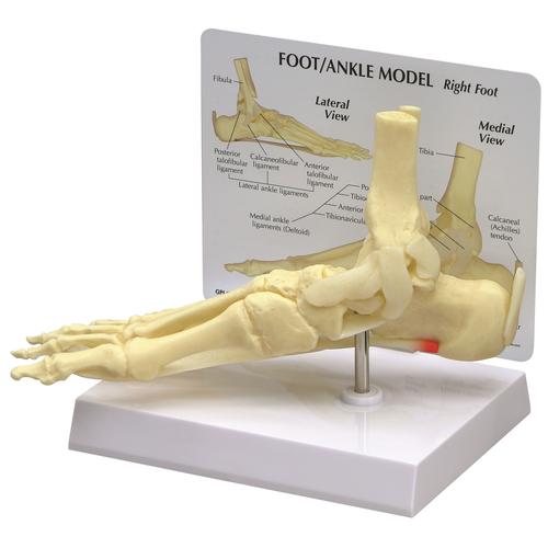 Модель стопы/голеностопного сустава - подошвенной фасциит, 1019522, Модели скелета ноги и стопы