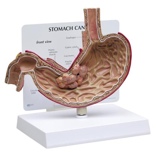 Modelo de Câncer Estomacal, 1019524, Modelo de sistema digestivo