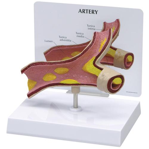 动脉模型, 1019531, 微观解剖模型。