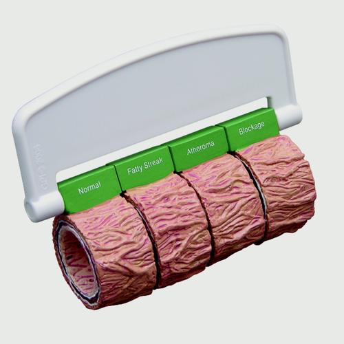 Artery sections (4) (oversized) - with Handle, 1019532, Microanatomy Models 