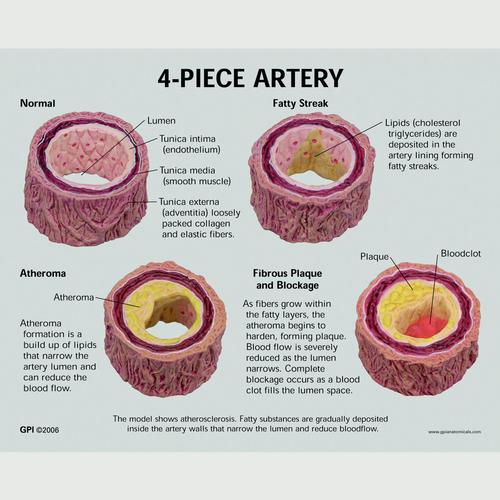 Сечения артерии (4) (с увеличением) - с держателем, 1019532, Модели микроанатомические