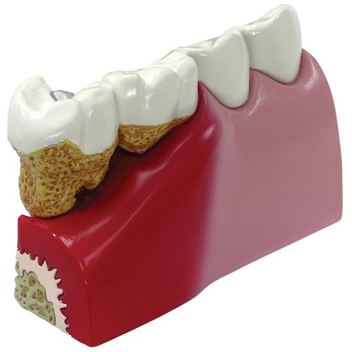 Modelo dos Dentes, 1019539, Modelos dentais