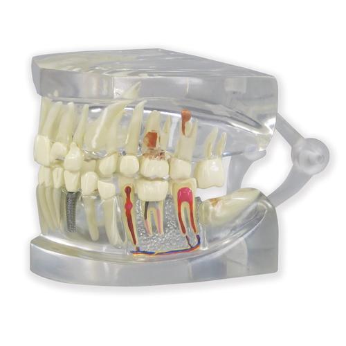 Прозрачная модель челюсти человека с зубами, 1019540, Модели зубов