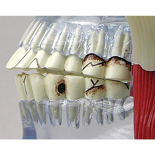 Модель ВНЧС, 1019541, Модели зубов