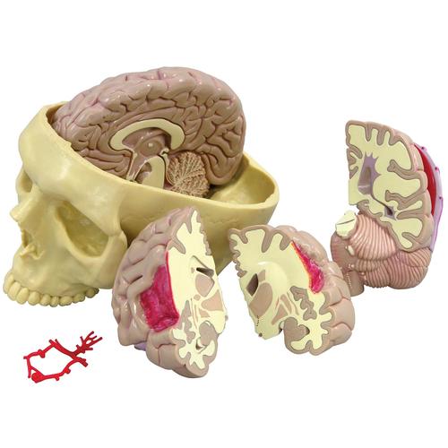 Modèle de cerveau, 1019542, Modèles de moulage de crânes humains