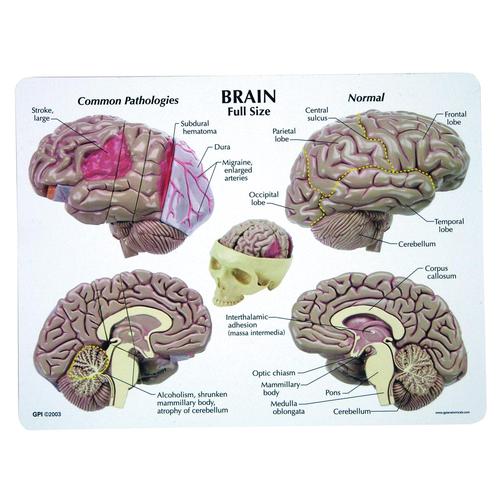 Mod&egrave;le de cerveau, 1019542, Mod&egrave;les de cerveaux