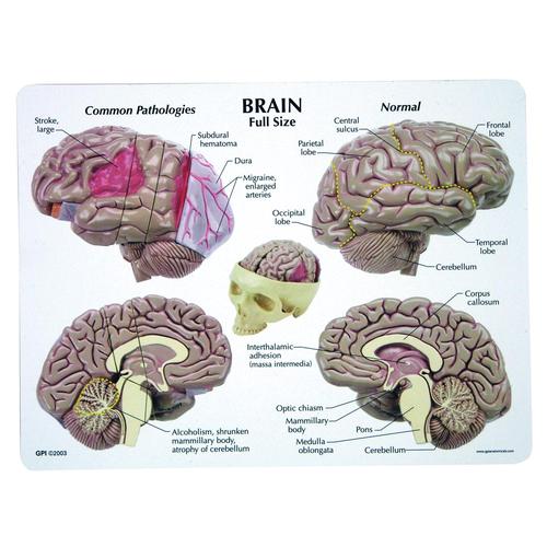 Модель головного мозга, 1019542, Модели мозга человека