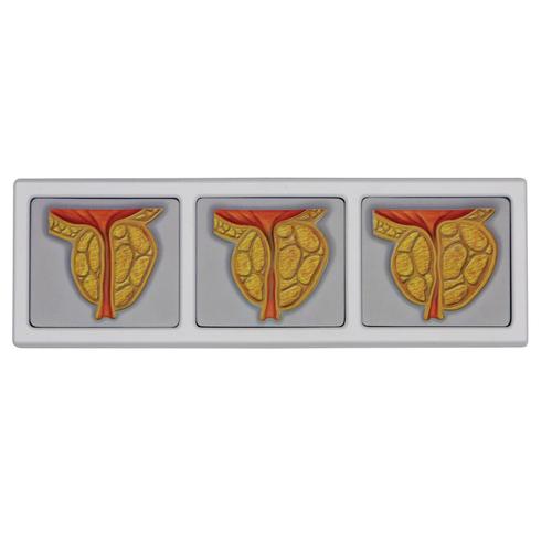 Bassin masculin avec cadre de prostate en 3D, 1019563, Modèles partie génitale et bassin