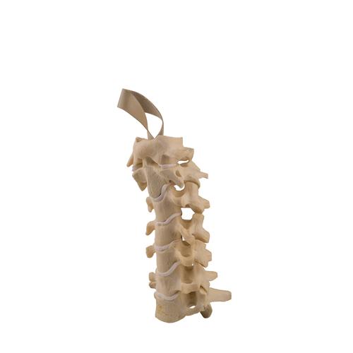 ORTHObones Línea Estándar Vértebras cervicales, 1019614, 3B ORTHObones Standard