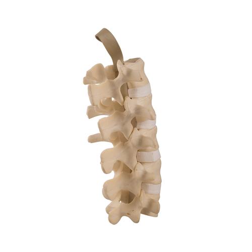 ORTHObones Standard Lumbar Spine, 1019700, 3B ORTHObones Standard