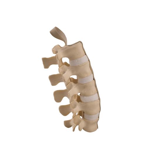 ORTHObones Standard Lumbar Spine, 1019700, 3B ORTHObones Standard