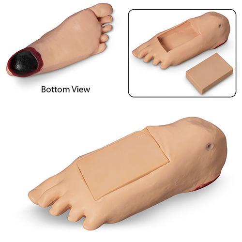 供同类模拟人使用的水肿脚部模型, 1019744, 褥疮护理