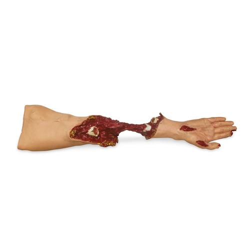 Braccio moulage Xtreme Trauma, 1020804, Advanced Trauma Life Support (ATLS)