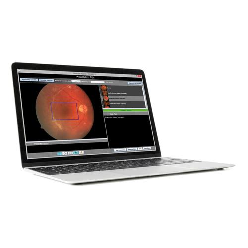 Educators Toolkit&trade; para OphthoSim&trade;, 1021956, Exame Otorrinolaringol&oacute;gico