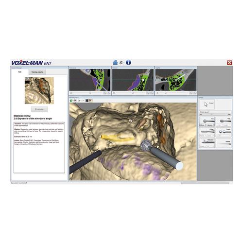 Voxel-Man ENT - Système ORL complet, 1022080, Enquête oto-rhino-laryngologiste (ORL)