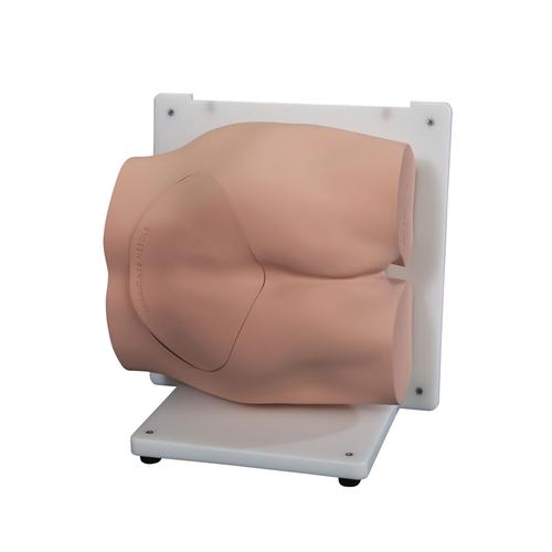 Bonnie Treinador de Habilidades de Bi&oacute;psia em Medula &Oacute;ssea&trade;, 1023340, Epidural e Espinhal