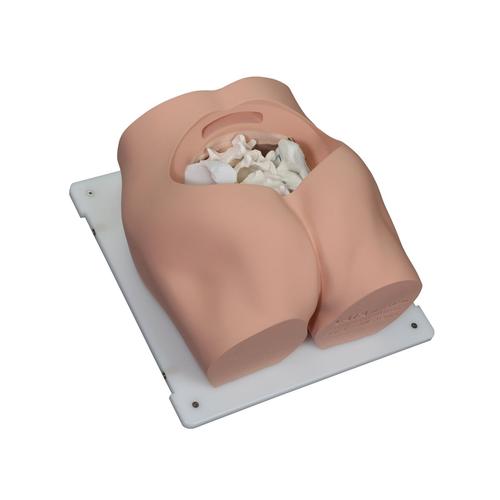 Bonnie Treinador de Habilidades de Bi&oacute;psia em Medula &Oacute;ssea&trade;, 1023340, Epidural e Espinhal