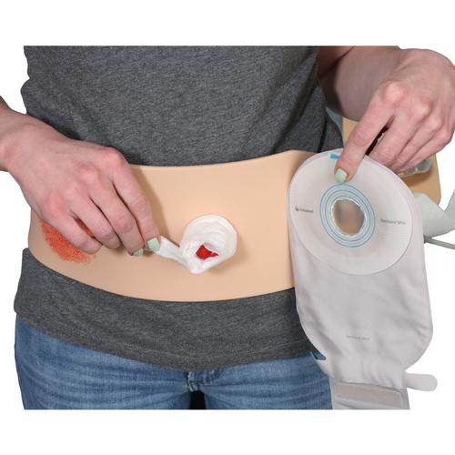 Treinador de Bolsa de Ostomia&trade;, pele clara, 1023347, Cuidados com Ostomia