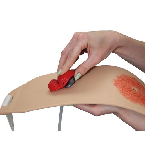 Treinador de Bolsa de Ostomia&trade;, pele clara, 1023347, Cuidados com Ostomia