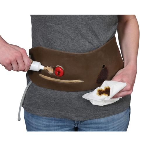 Ostomy Pouching Trainer&trade;, dark skin, 1023348, Ostomy Care