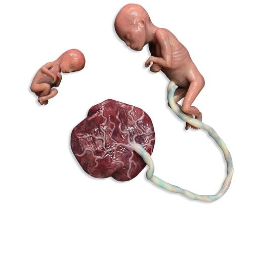 Manichino di feto abortito
, 1024667, Newborn