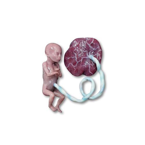 Manichino di feto abortito
, 1024667, Women's Health Education