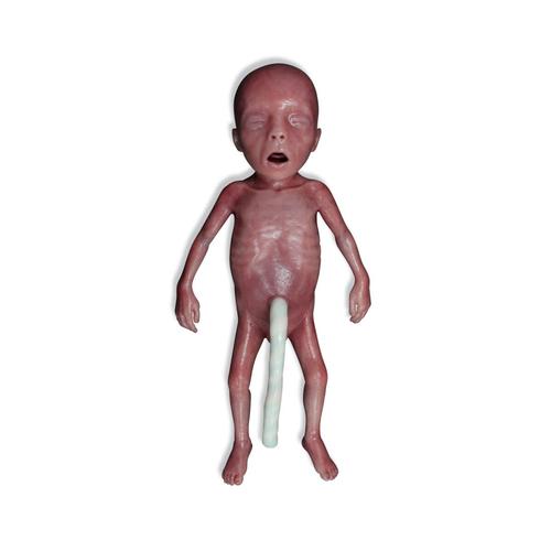Lifecast Micro-preemie csecsemő / Extr&eacute;m alacsony sz&uuml;let&eacute;si s&uacute;ly&uacute; csecsemő (ELBW), 1024668, Newborn