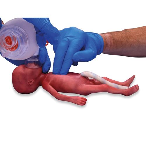 Bebê Micro-Prematuro / Bebê de Peso Extremamente Baixo no Parto (ELBW)
, 1024668, Newborn