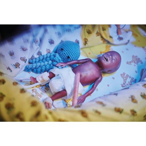 Bebé microprematuro / Pretérmino de peso extremadamente bajo al nacer (PEBN)
, 1024668, Newborn
