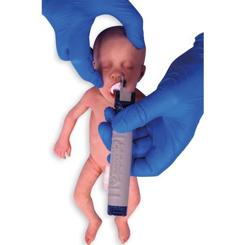 Bebé pretérmino Caucásico / Hombre, 1024669, ALS neonatal