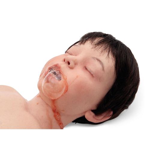 Lifecast 3 Yaşında &Ccedil;ocuk (G&ouml;ğ&uuml;s Travmalı / A&ccedil;ık Tenli / Erkek), 1024730, Infant and Child&nbsp;