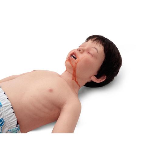 Lifecast 3 Yaşında &Ccedil;ocuk (G&ouml;ğ&uuml;s Travmalı / A&ccedil;ık Tenli / Erkek), 1024730, Infant and Child&nbsp;