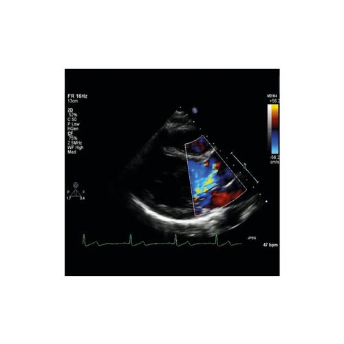 Mannequin d&rsquo;auscultation &agrave; peau claire SAM4 Plus, 1025098, Auscultation