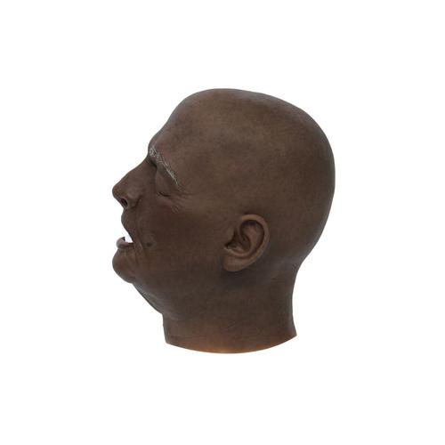 EchoMask&reg; Middle-Aged Male Stroke Patient Dark Skin (40-55 Years Old), 1025317, Echo Mask