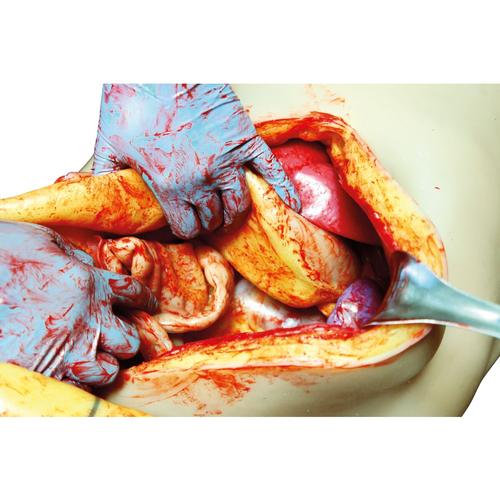 ASSP for OS3 - Abdominal package, 1025868, TCCC and TECC