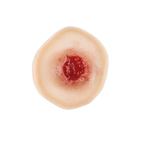 Ferimento por Arma de Fogo 7,62mm (Entrada - Conjunto de 2) - Pele Clara, 1025925, Pe&ccedil;as de reposi&ccedil;&atilde;o