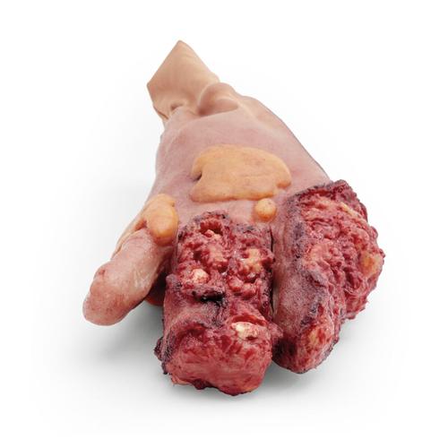 Partial Right Hand Amputation Sleeve - Light Skin, 1025936, Ersatzteile