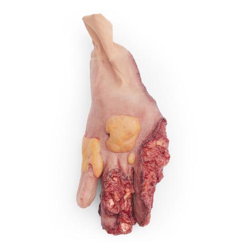 Partial Right Hand Amputation Sleeve - Light Skin, 1025936, Ersatzteile