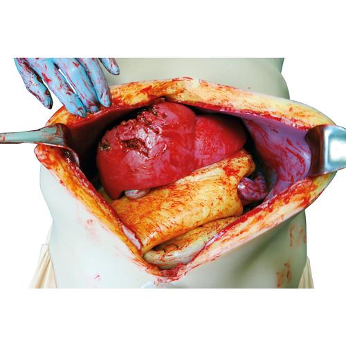 Open Surgical Simulation System (OS3), 1025950, Surgical Procedures Training