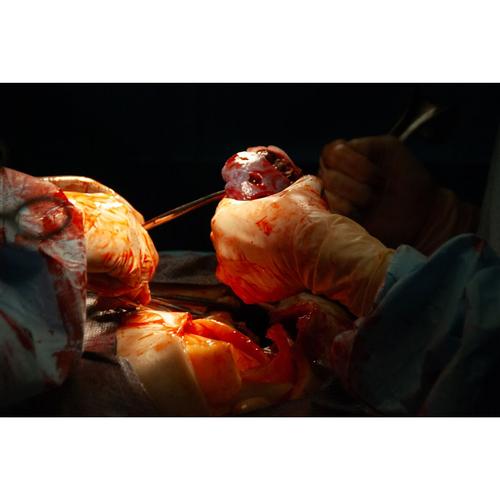 Surgical Cut Suit (TCCC/EMS Capabilities) - Light Skin, 1025958, Surgical Procedures Training