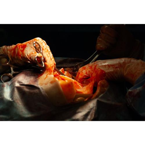 Surgical Cut Suit (TCCC/EMS Capabilities) - Light Skin, 1025958, Surgical Procedures Training
