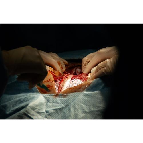 Surgical Cut Suit (TCCC/EMS Capabilities) - Light Skin, 1025958, Surgical Procedures Training