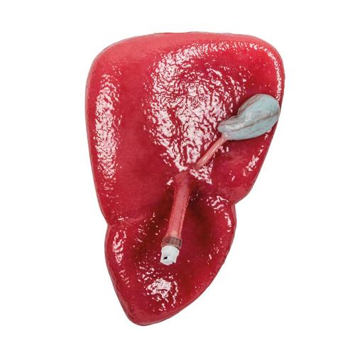 Liver w/ Gallbladder, 1025971, Replacements