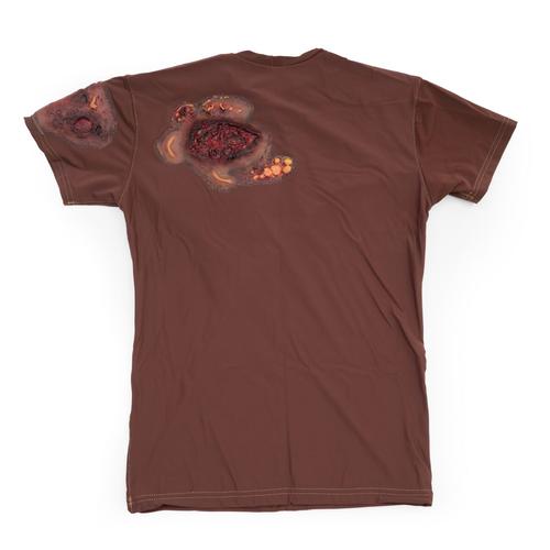 Full Thickness Burns to Chest and Back - Short Sleeve - Dark Skin, 1025985, Replacements
