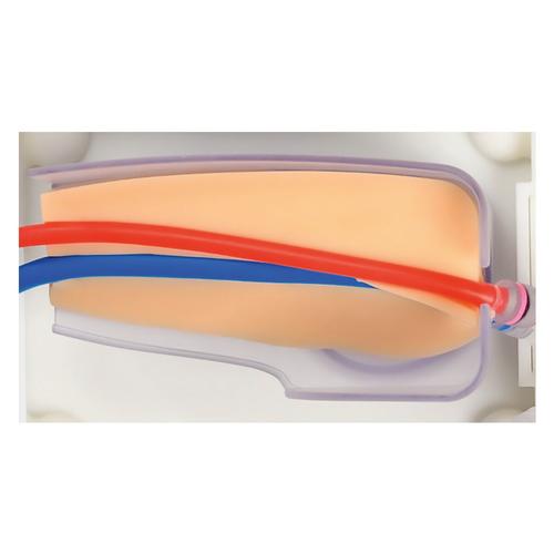 Simulador Avan&ccedil;ado de Acesso Vascular Femoral, 1026904, Inje&ccedil;&otilde;es e Pun&ccedil;&atilde;o